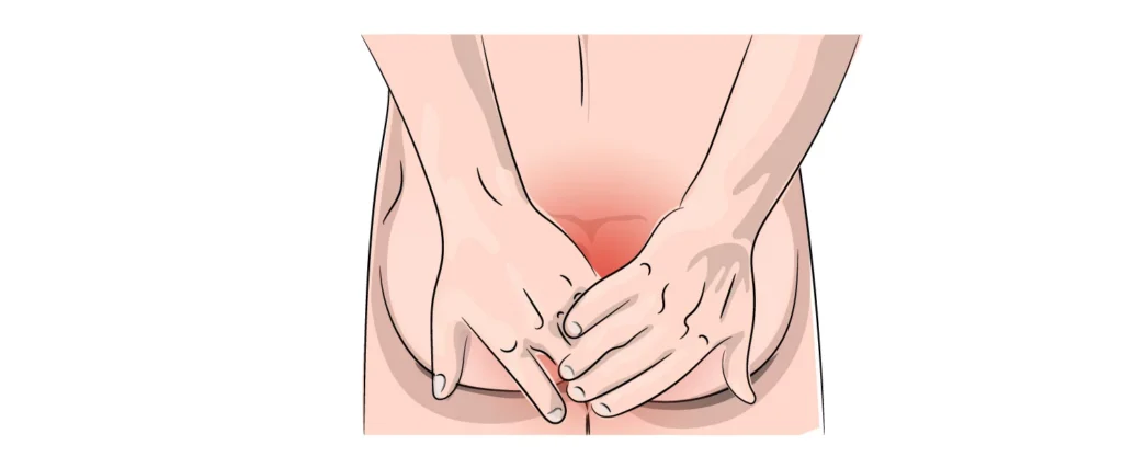 Prurito anal (Pruritus Ani)