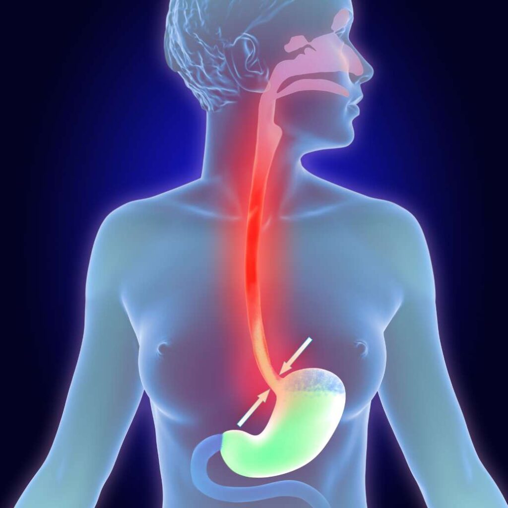 Dispepsia