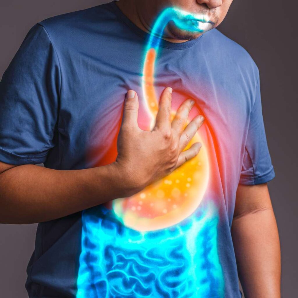 Hombre con reflujo gastroesofágico