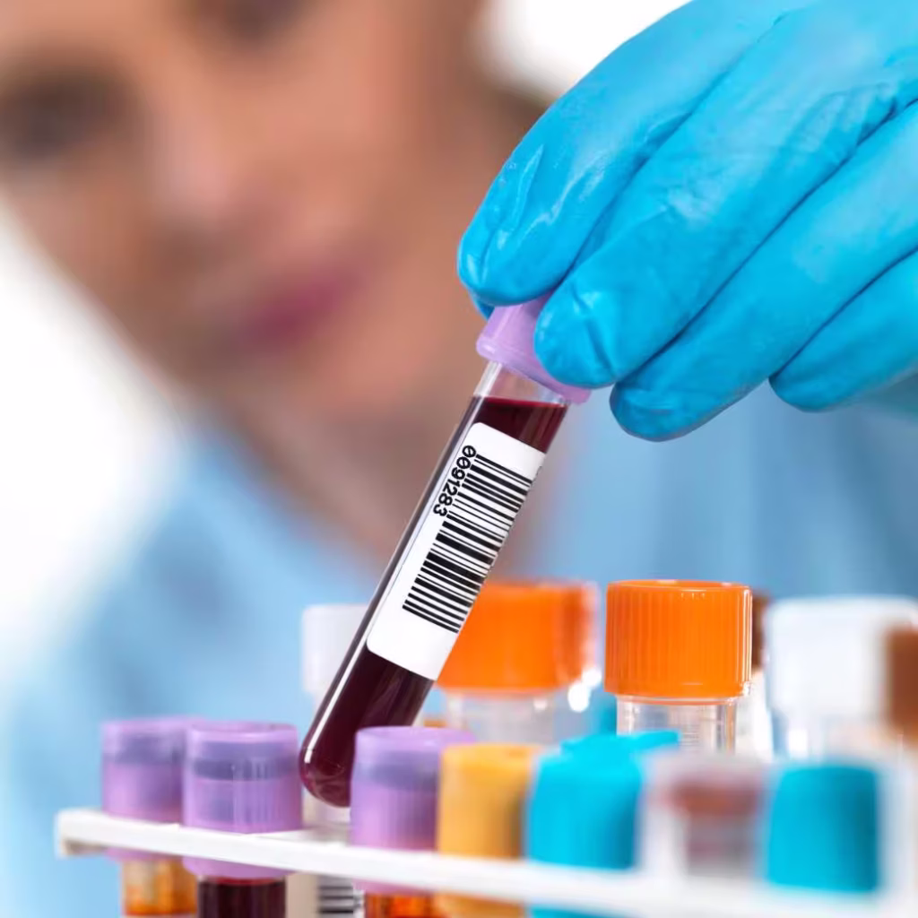 Persona que sostiene la muestra de sangre